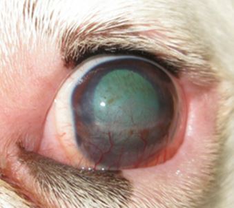 A good surgical outcome, considering the severity of damage to this cornea